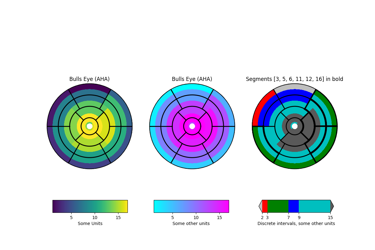 Bulls Eye (AHA), Bulls Eye (AHA), Segmente [3, 5, 6, 11, 12, 16] in Fettdruck