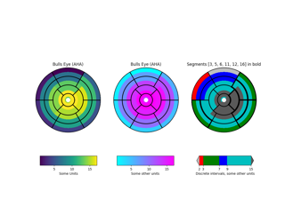 Bullseye des linken Ventrikels