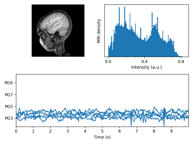 mrt mit eeg