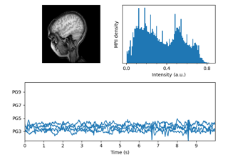 MRT mit EEG